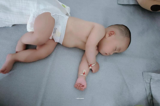 六安宝宝褶皱处擦粉还是油